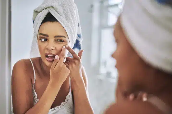 Rendon Center IPL Treatment for Skin Imperfections.jpg