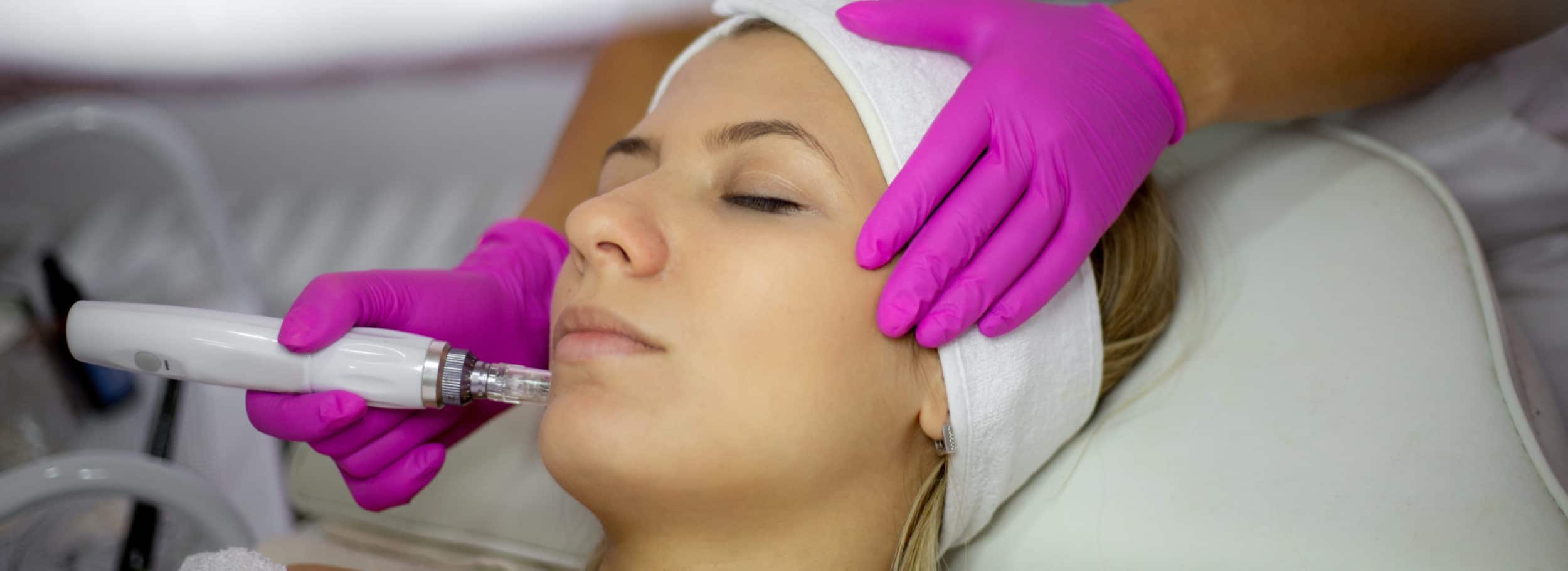 Microneedling Treatment Image scaled Microneedling Treatment Image scaled