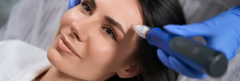 Benefits of RF Microneedling.png