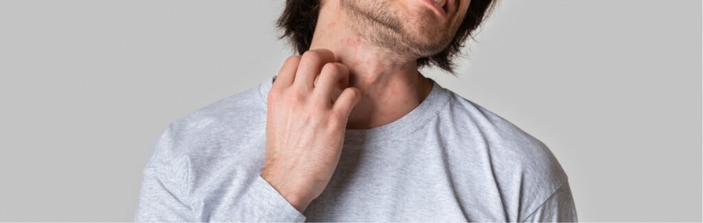 Rashes 1.2x.jpg