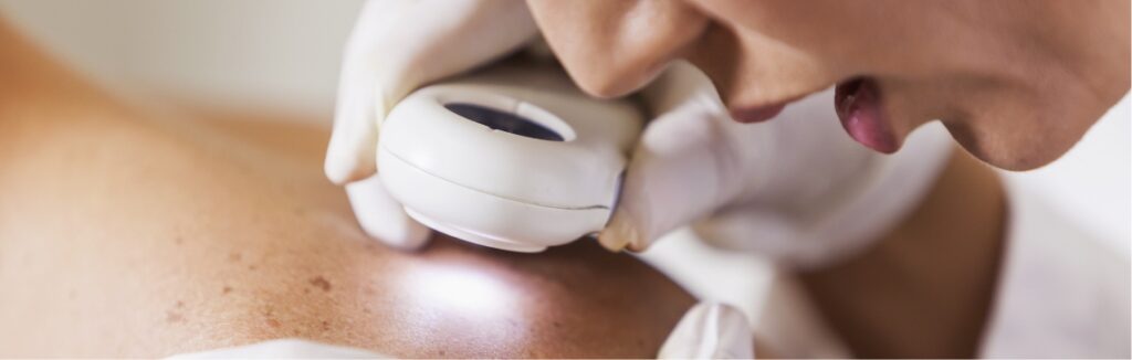 mohs surgery 1.2x.jpg