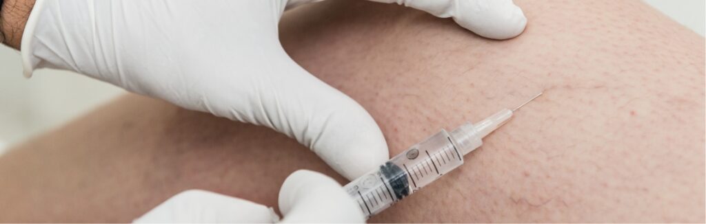 sclerotherapy 1.2x.jpg