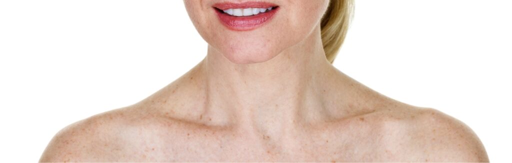 sun damage 1.2x.jpg