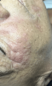 After Image: Extractions