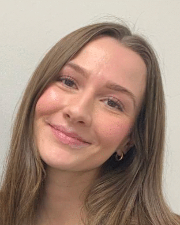 Before Image: Lip Filler - front